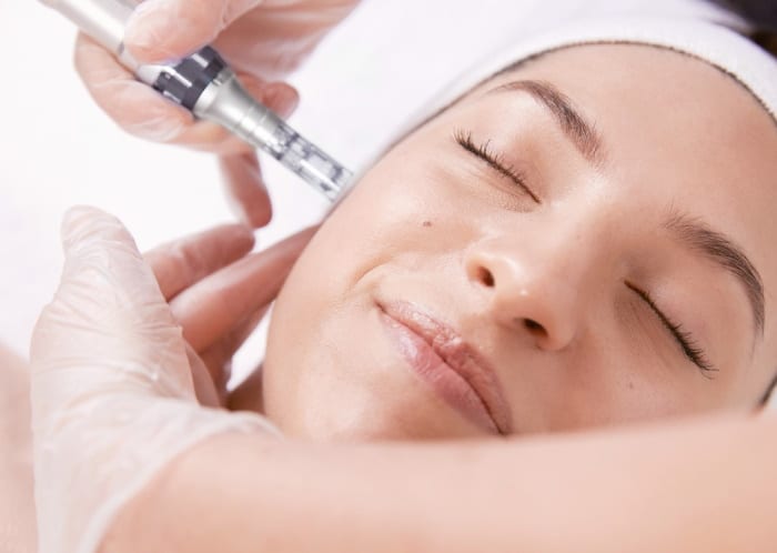 Needling