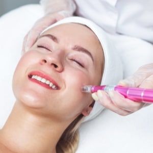 Microneedling